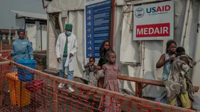 مراكز صحية لمتابعة جدري القردة 