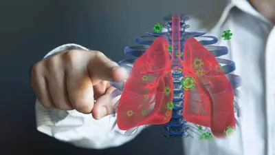 سرطان الرئة