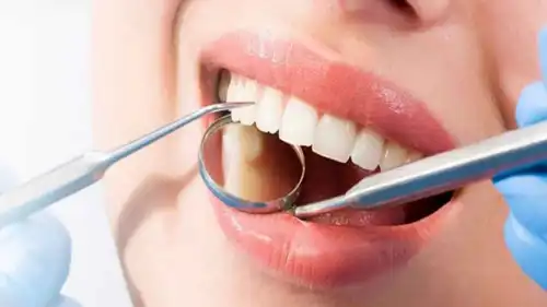 فحص الأسنان