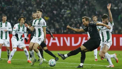 مباراة بايرن ميونخ وبروسيا مونشنغلادباخ في الدوري الألماني