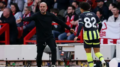 غوارديولا في مباراة مانشستر سيتي ونوتينغهام