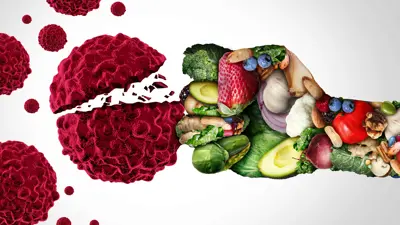 (مضادات الأكسدة والسرطان (تعبيرية