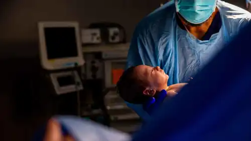 عملية ولادة- تعبيرية