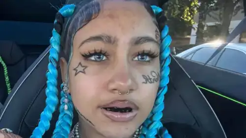 نورث ويست تضع اكسسوارات الأسنان