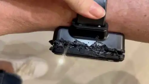 سوار الكاحل التالف للرئيس البرازيلي السابق جايير بولسونارو