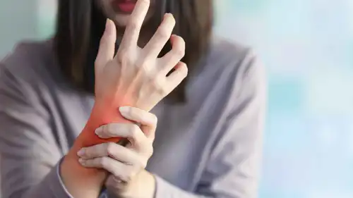 التهاب المفاصل الروماتويدي