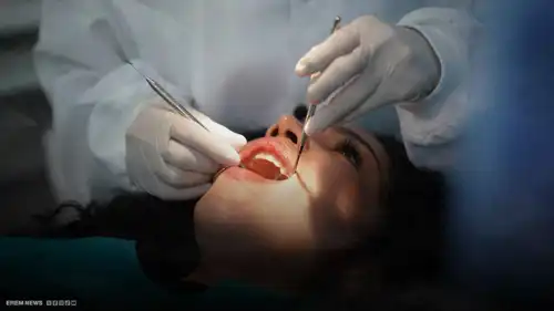 ابتسامة بلا جراحة.. ابتكار هلام يُجدد الأسنان كالسحر