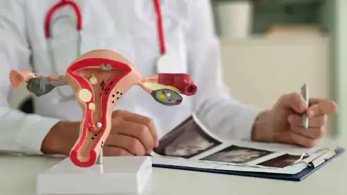 طبيب يشرح لمريضة التغيرات في المبايض باستخدام نموذج للرحم