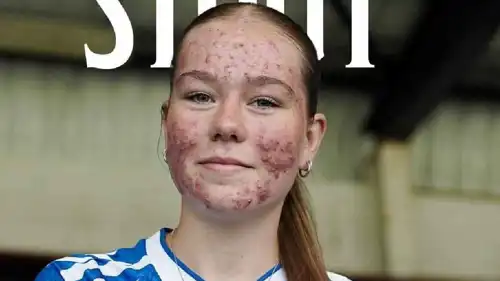 اللاعبة الاسكتلندية سكاي ستاوت