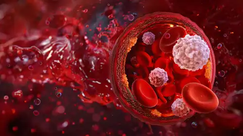 فقر الدم والسرطان - تعبيرية