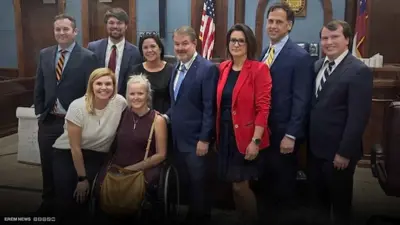 70 مليون دولار.. تعويض لأمريكية فقدت ساقيها بسبب خطأ طبي