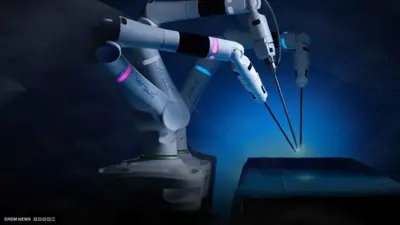"الروبوتات الجراحية" تطرق أبواب غرف العمليات البشرية