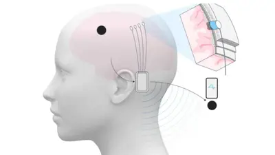 رسم توضيحي لعمل الشريحة الدماغية