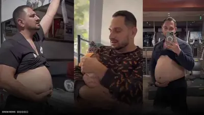 رجل عربى يحمل بطفلة ويلدها بعملية قيصرية