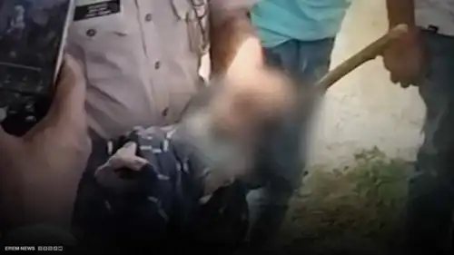 معجزة تنقذ حياة طفلة