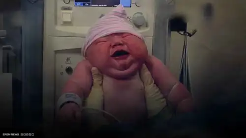 ولادة طفل عملاق