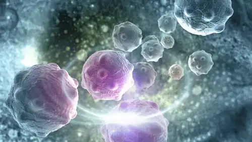 أورام سرطانية 