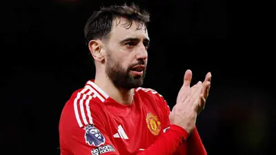 برونز فيرنانديز