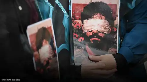 أحد مصابي حادث البيجر