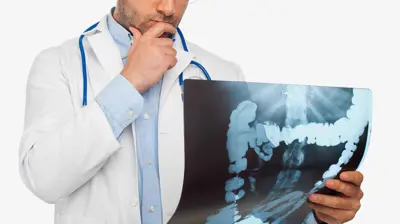 سرطان القولون