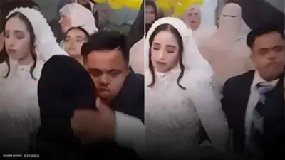 هل يجوز زواج شاب من متلازمة داون؟