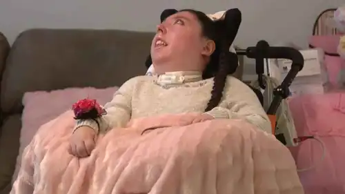 أليكس سيمبسون