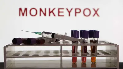 جرعات فحوصات "جدري القردة" (تعبيرية)