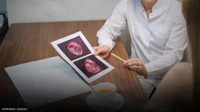 مركز طبي يتاجر ببويضات النساء