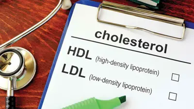 الكوليسترول