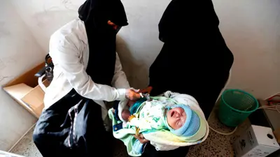 طفل يمني يتلقى لقاح شلل الأطفال في ضواحي صنعاء