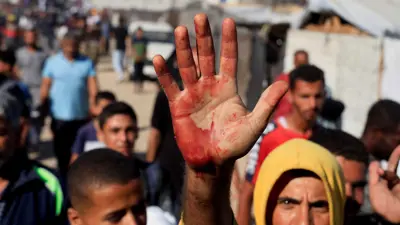 شاب يرفع يده الملطخة بالدماء أثناء توزيع المساعدات وسط غزة