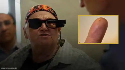 عين إلكترونية تعيد البصر